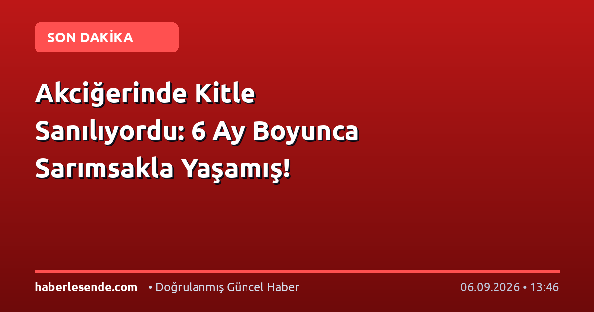 Akciğerinde Kitle Sanılıyordu: 6 Ay Boyunca Sarımsakla Yaşamış!