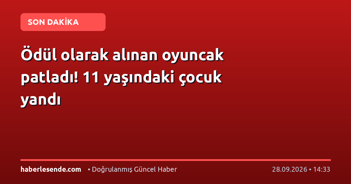 Ödül olarak alınan oyuncak patladı! 11 yaşındaki çocuk yandı