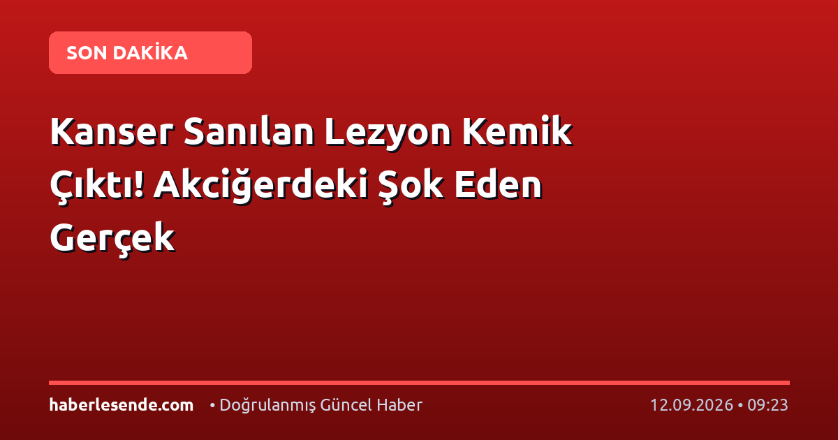 Kanser Sanılan Lezyon Kemik Çıktı! Akciğerdeki Şok Eden Gerçek