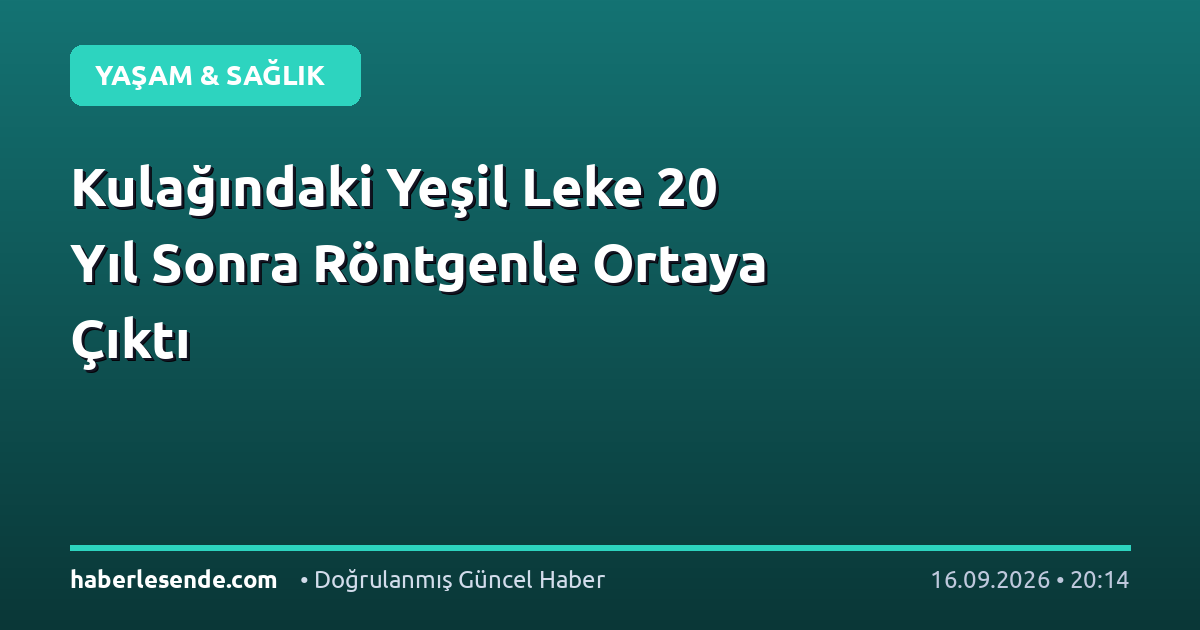 Kulağındaki Yeşil Leke 20 Yıl Sonra Röntgenle Ortaya Çıktı
