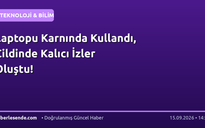 Laptopu Karnında Kullandı, Cildinde Kalıcı İzler Oluştu!