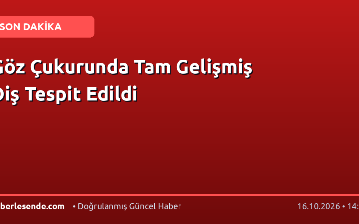 Göz Çukurunda Tam Gelişmiş Diş Tespit Edildi